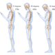 Illustration for article titled My Smartphone Gave Me a Painful Neurological Condition